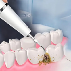Scaler with LED light, Rechargeable Tooth Plaque Remover